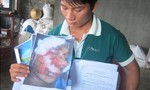 Quản lý trại tôm suýt mất mạng  tại Bình Định: Do tai nạn hay bị đánh “dằn mặt”?