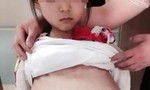 Bé gái 12 tuổi mang thai tại Trung Quốc bất ngờ thay đổi lời khai