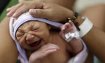 Đã phát hiện virus Zika gây bệnh đầu nhỏ trong sữa mẹ