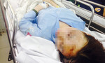 Clip hai nữ sinh bị tạt axit ở Sài Gòn vùng vẫy trong đau đớn