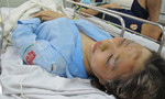 Nữ sinh bị tạt axít giữa Sài Gòn bị mù mắt