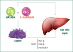Giải mã tế bào Kupffer - “thủ phạm” gây bệnh cho gan