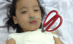 Bé gái 5 tuổi bị kéo cắt tôm đâm lút cán, xuyên thấu ngực