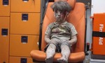 Cậu bé bị thương trong cuộc chiến Syria gây xúc động toàn cầu