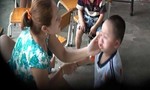 TP.HCM: Cháu bé 3 tuổi nghi bị cô giáo đánh bầm mắt