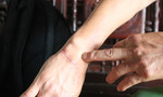 Thanh niên chém đứt gân cổ tay cảnh sát khu vực lãnh án