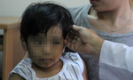 Bé gái 7 tuổi mắc bệnh 'công chúa tóc dài' kỳ quái, nghiện ăn tóc chính mình
