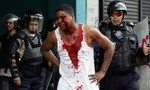 Biểu tình rầm rộ tại Venezuela khiến 3 người thiệt mạng