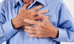 Một bảo vệ lên cơn đau tim suýt chết sau ca trực đêm