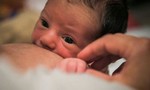 Pháp điều tra hàng chục trường hợp trẻ sơ sinh không có tay