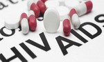 Hơn 50.000 người nhiễm HIV chưa biết tình trạng nhiễm bệnh