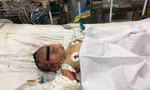 Nổ bình gas mini, mẹ mang thai và bé 15 tháng tuổi bỏng nặng