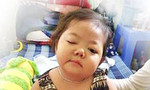 Bé gái 3 tuổi mang bệnh u thân não hiểm nghèo cần giúp đỡ