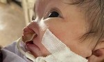 Xin giúp cháu bé vừa chào đời đã mắc bệnh hiểm nghèo!