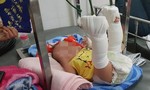 TPHCM: Bắt giam người cha đánh con 4 tháng tuổi gãy chân