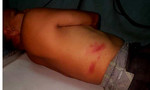 Quảng Nam: Xác minh cô gái đánh cụ ông bị thương