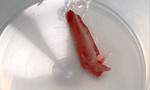 Mảnh xương cá gai góc 'trốn' trong phổi bé trai 13 tháng tuổi