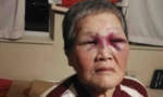 Cụ bà gốc Hoa đánh trả khi bị tấn công ở Mỹ