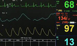 Làm thế nào để kiểm soát nhịp tim ở mức ổn định?