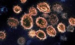 Đông Á từng bị "nhấn chìm" trong trận dịch coronavirus cách đây 20.000 năm?