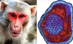 Trung Quốc ghi nhận ca tử vong đầu tiên do virus Monkey B lây nhiễm từ linh trưởng