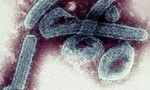 Châu Phi ghi nhận sự xuất hiện của virus Marburg, nguy hiểm giống Ebola