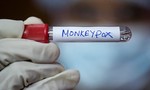 Ấn Độ có ca tử vong đầu tiên vì bệnh đậu mùa khỉ
