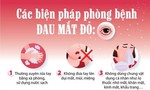 TPHCM: Số ca mắc đau mắt đỏ tăng nhanh