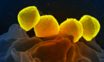 Nhật ghi nhận các ca nhiễm khuẩn chết người tăng vọt
