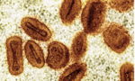 Hai nhà khoa học bị buộc tội lén đưa virus đậu mùa khỉ bất hoạt vào Mỹ