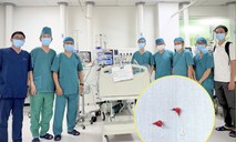 TPHCM: Hai bệnh viện nhi phối hợp cấp cứu cháu bé 7 tháng tuổi hóc xương lươn