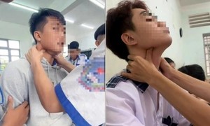 Cảnh báo trào lưu "bắt pen" lan rộng trên TikTok có thể gây ngưng tim