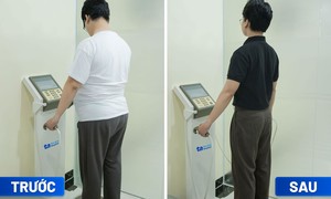 Trung tâm Giảm cân chuẩn y khoa quốc tế BVĐK Tâm Anh tiếp nhận hơn 1.000 ca giảm cân