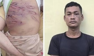 Công an TPHCM bắt giữ cặp đôi ác nhân bạo hành dã man cháu bé 2 tuổi, gây phẫn nộ dư luận