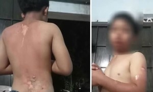 Khẩn trương xác minh làm rõ thông tin bé trai nghi bị mẹ tạt nước sôi gây bỏng nặng
